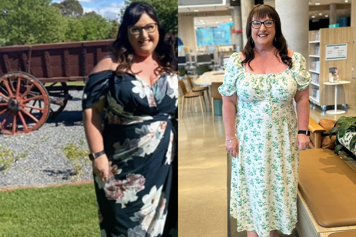 Jayne's before and after photo, wearing a floral dress.