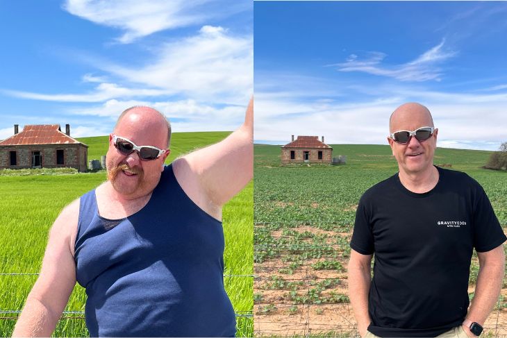 Ray before and after photos, side by side.